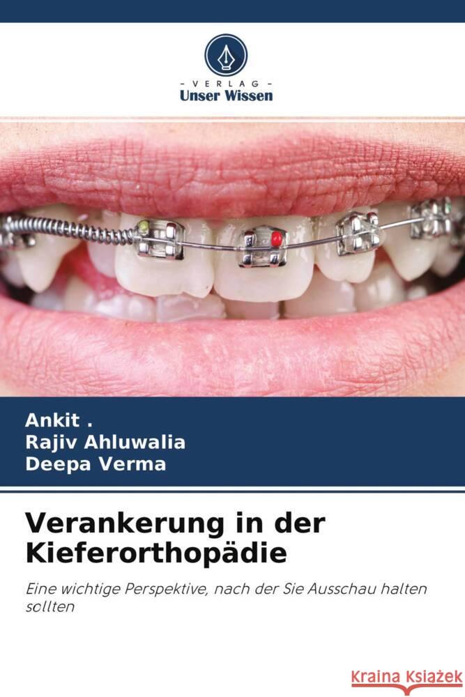 Verankerung in der Kieferorthopädie ., Ankit, Ahluwalia, Rajiv, Verma, Deepa 9786204253183