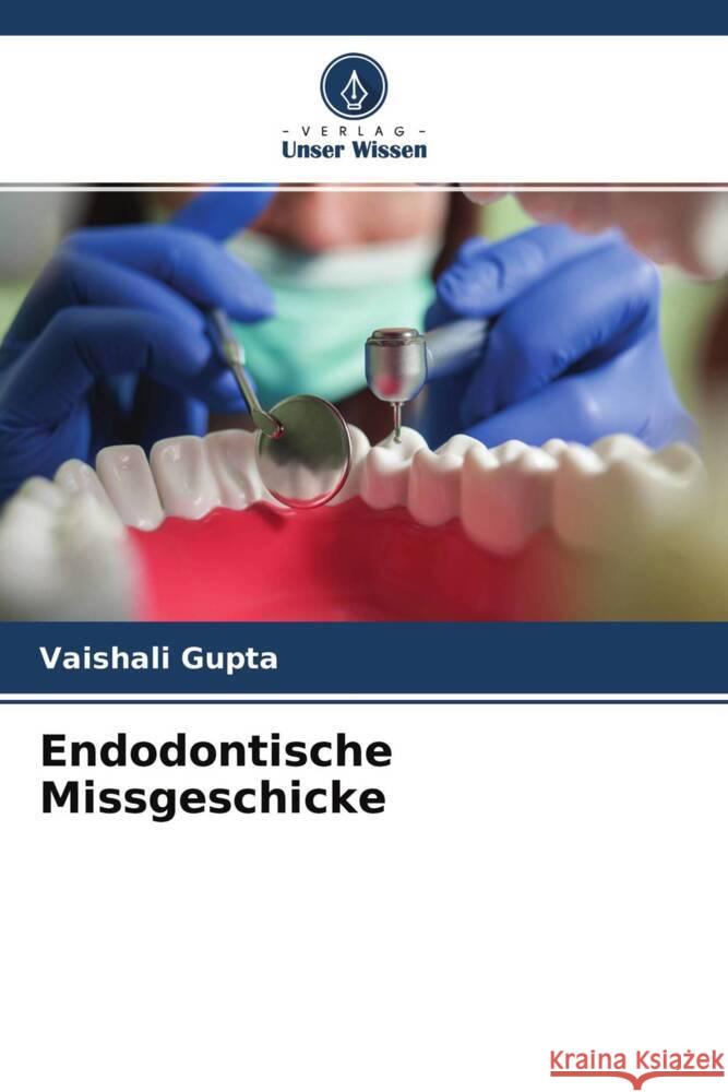 Endodontische Missgeschicke Gupta, Vaishali 9786204269481