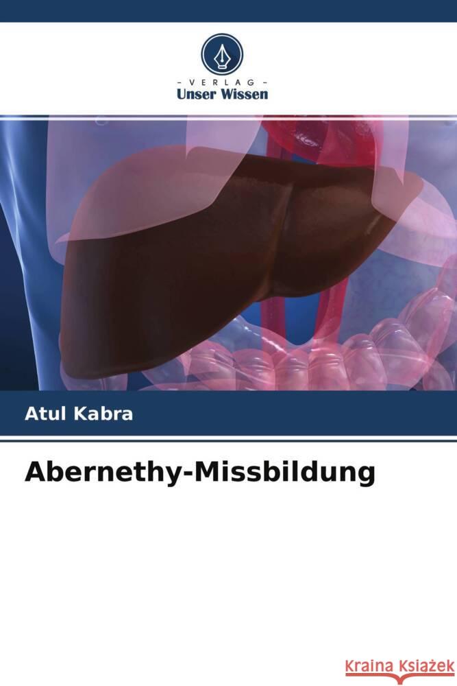 Abernethy-Missbildung Kabra, Atul 9786204294216