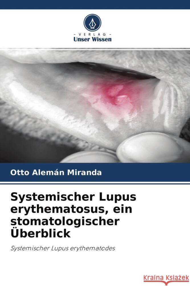 Systemischer Lupus erythematosus, ein stomatologischer Überblick Alemán Miranda, Otto 9786204326375