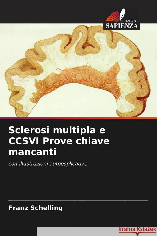 Sclerosi multipla e CCSVI Prove chiave mancanti Schelling, Franz 9786204376387 Edizioni Sapienza