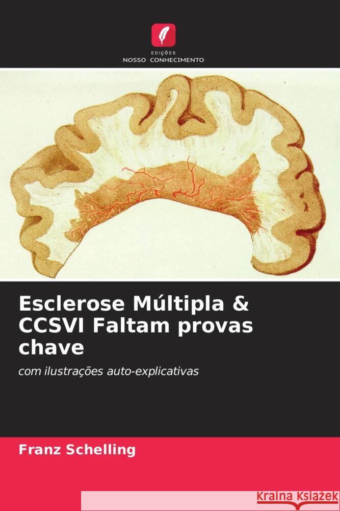 Esclerose Múltipla & CCSVI Faltam provas chave Schelling, Franz 9786204376394 Edicoes Nosso Conhecimento