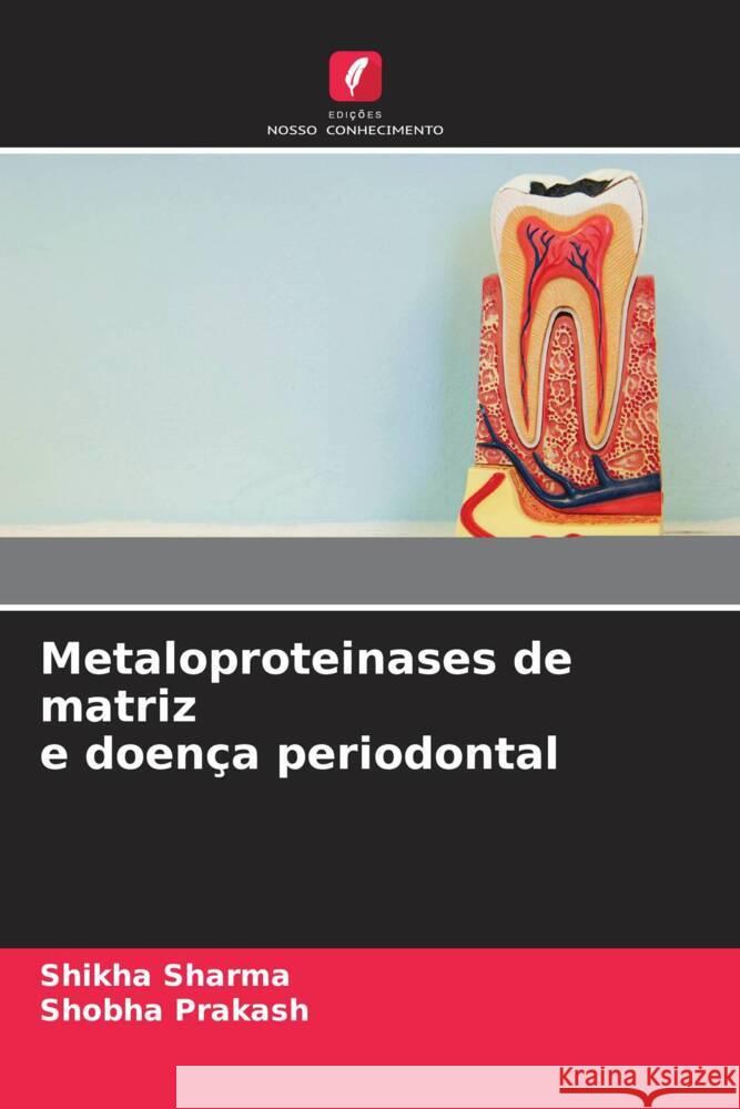 Metaloproteinases de matriz e doença periodontal Sharma, Shikha, Prakash, Shobha 9786204376646 Edicoes Nosso Conhecimento