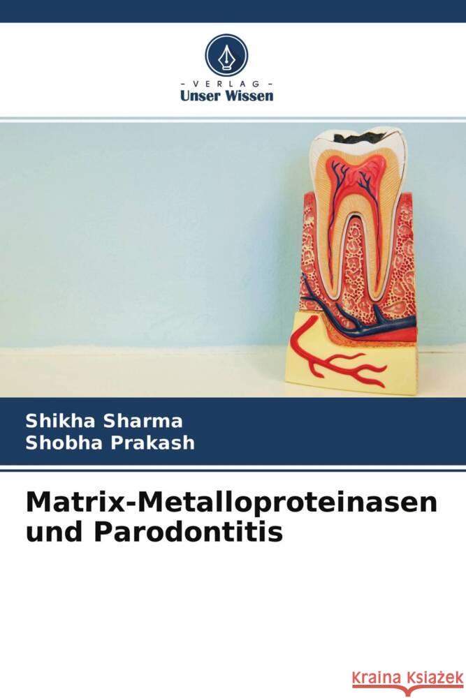 Matrix-Metalloproteinasen und Parodontitis Sharma, Shikha, Prakash, Shobha 9786204376707 Verlag Unser Wissen