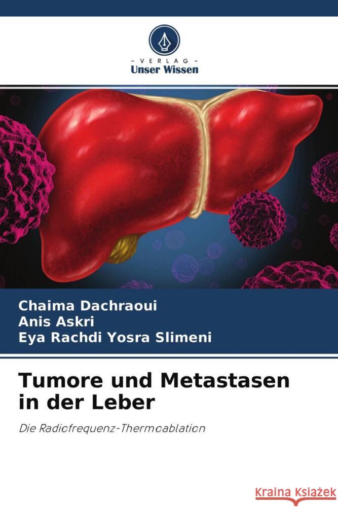 Tumore und Metastasen in der Leber Dachraoui, Chaima, Askri, Anis, Yosra Slimeni, Eya Rachdi 9786204377001