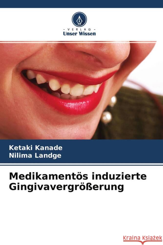 Medikamentös induzierte Gingivavergrößerung Kanade, Ketaki, Landge, Nilima 9786204379487