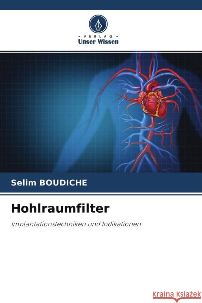 Hohlraumfilter Boudiche, Selim 9786204392790 Verlag Unser Wissen