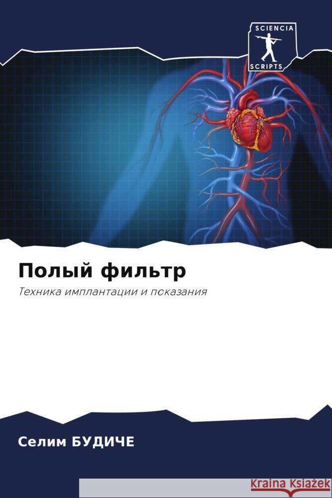 Polyj fil'tr BUDIChE, Selim 9786204392844