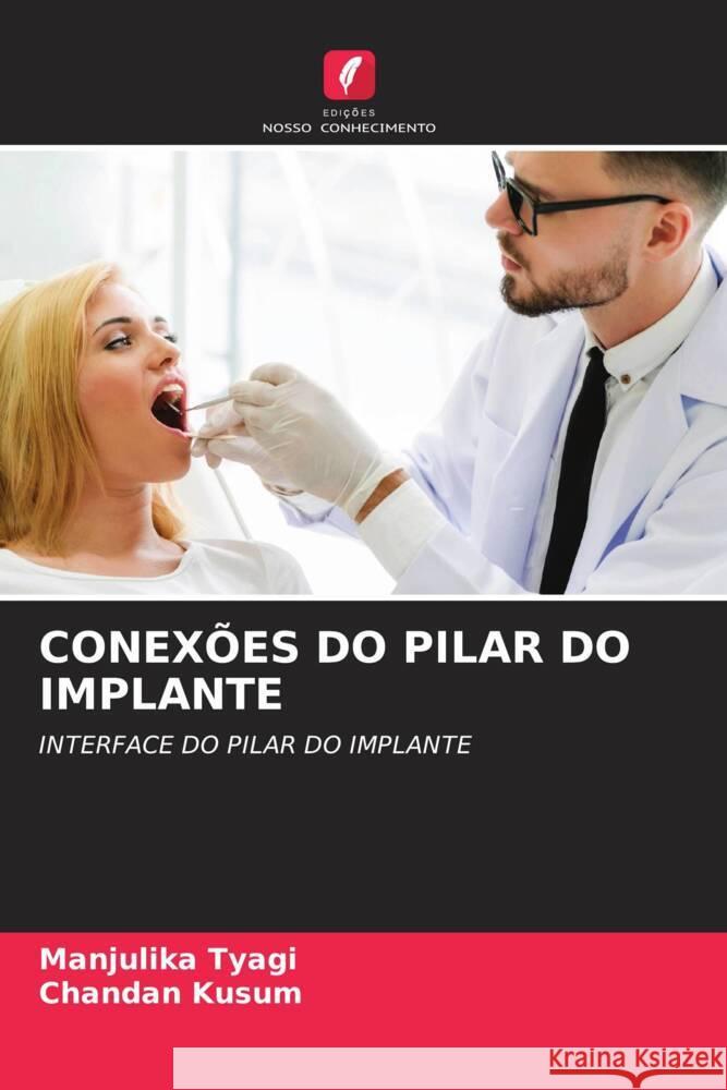 CONEXÕES DO PILAR DO IMPLANTE tyagi, manjulika, Kusum, chandan 9786204402727