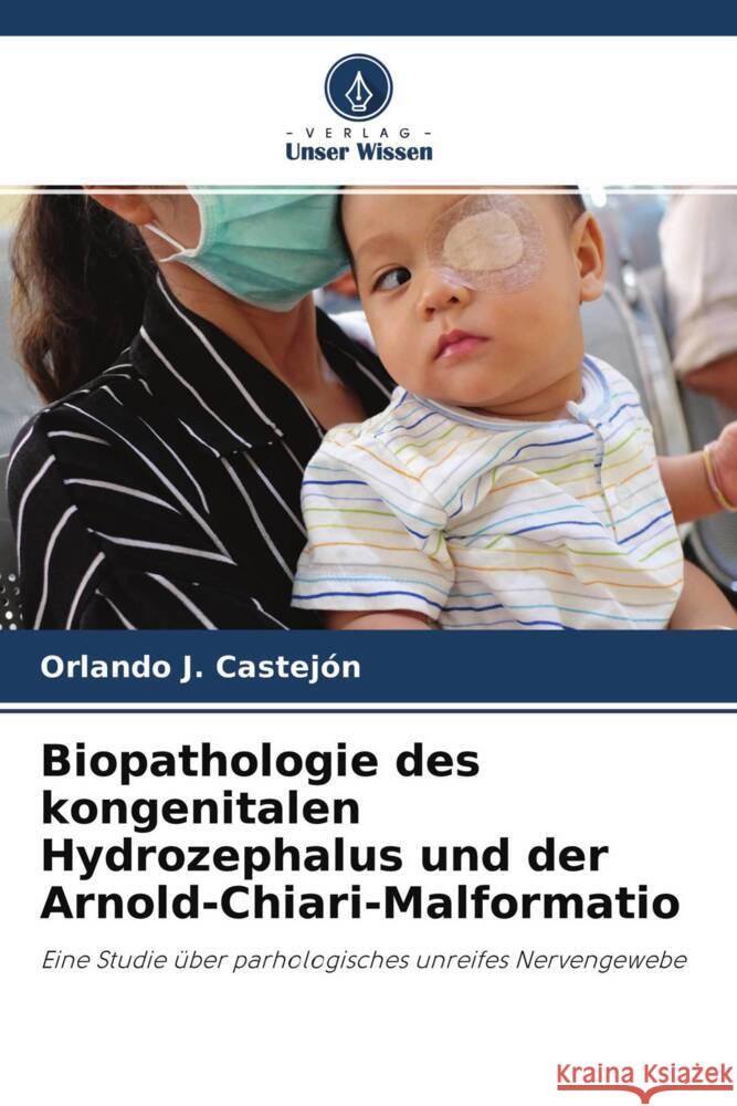 Biopathologie des kongenitalen Hydrozephalus und der Arnold-Chiari-Malformatio Castejón, Orlando J. 9786204402932