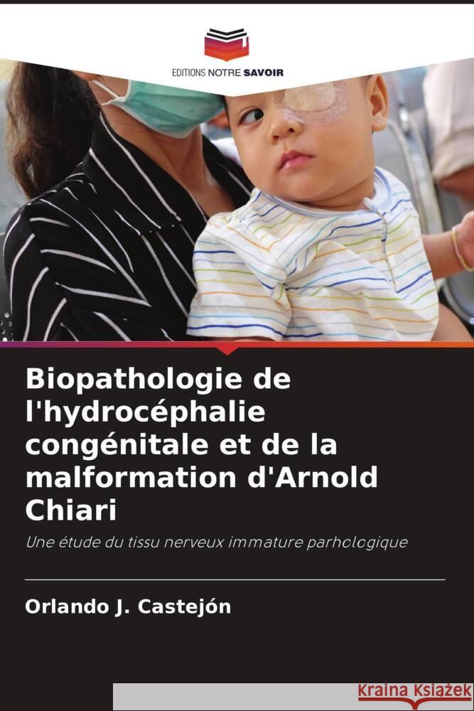 Biopathologie de l'hydrocéphalie congénitale et de la malformation d'Arnold Chiari Castejón, Orlando J. 9786204402956