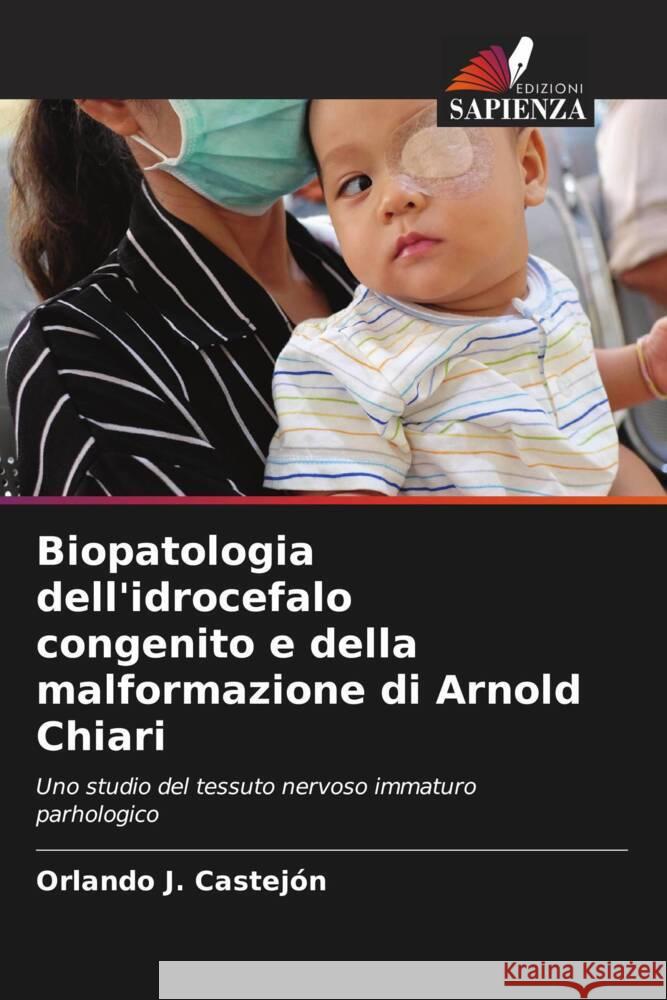 Biopatologia dell'idrocefalo congenito e della malformazione di Arnold Chiari Castejón, Orlando J. 9786204402963