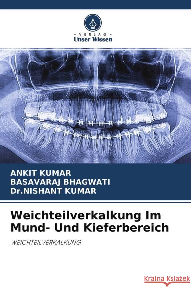 Weichteilverkalkung Im Mund- Und Kieferbereich Kumar, Ankit, Bhagwati, Basavaraj, Kumar, Dr.nishant 9786204403953 Verlag Unser Wissen