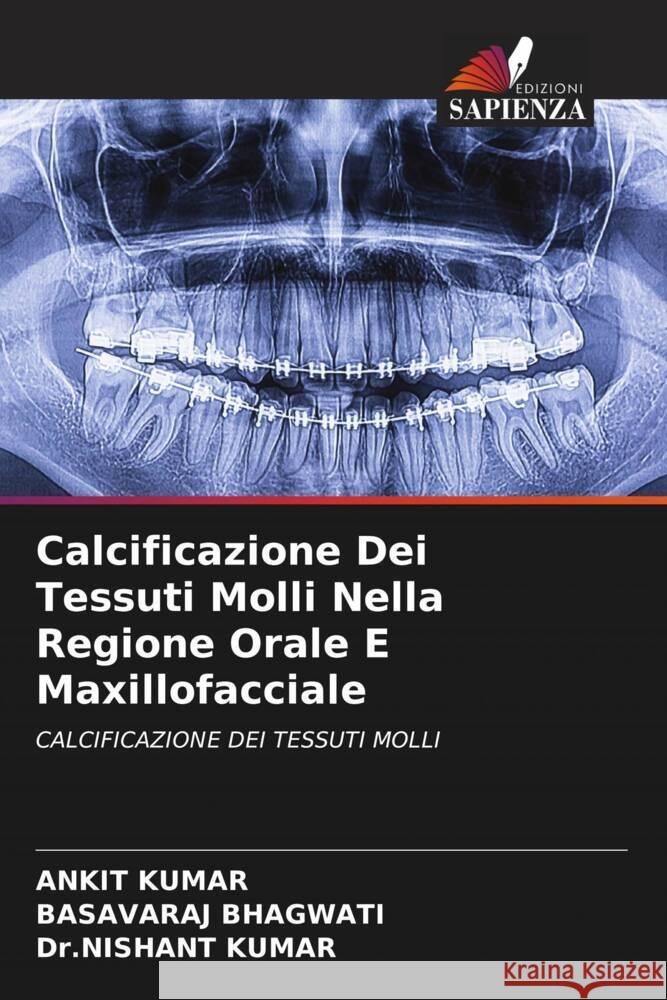 Calcificazione Dei Tessuti Molli Nella Regione Orale E Maxillofacciale Kumar, Ankit, Bhagwati, Basavaraj, Kumar, Dr.nishant 9786204404004 Edizioni Sapienza