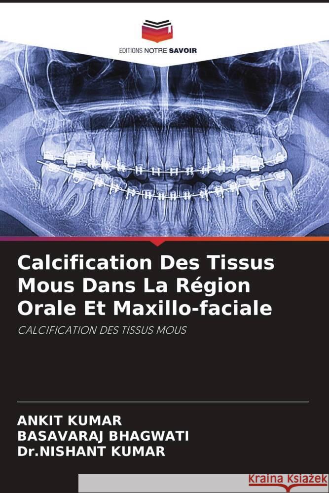 Calcification Des Tissus Mous Dans La Région Orale Et Maxillo-faciale Kumar, Ankit, Bhagwati, Basavaraj, Kumar, Dr.nishant 9786204404042 Editions Notre Savoir