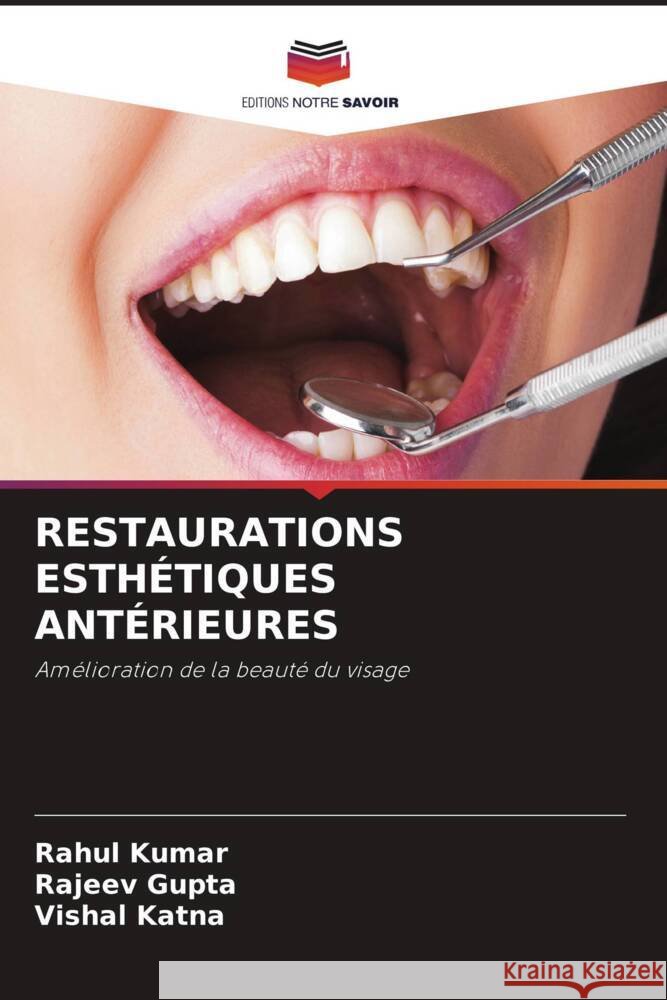RESTAURATIONS ESTHÉTIQUES ANTÉRIEURES Kumar, Rahul, Gupta, Rajeev, Katna, Vishal 9786204407326