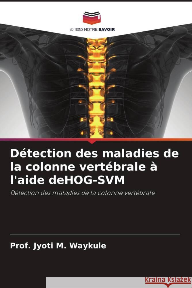 Détection des maladies de la colonne vertébrale à l'aide deHOG-SVM Waykule, Prof. Jyoti M. 9786204409863 Editions Notre Savoir