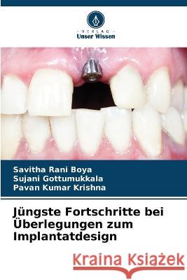 Jungste Fortschritte bei UEberlegungen zum Implantatdesign Savitha Rani Boya Sujani Gottumukkala Pavan Kumar Krishna 9786204409931 International Book Market Service Ltd