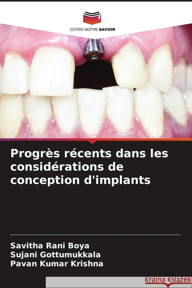 Progrès récents dans les considérations de conception d'implants Boya, Savitha Rani, Gottumukkala, Sujani, Krishna, Pavan Kumar 9786204409962 Editions Notre Savoir