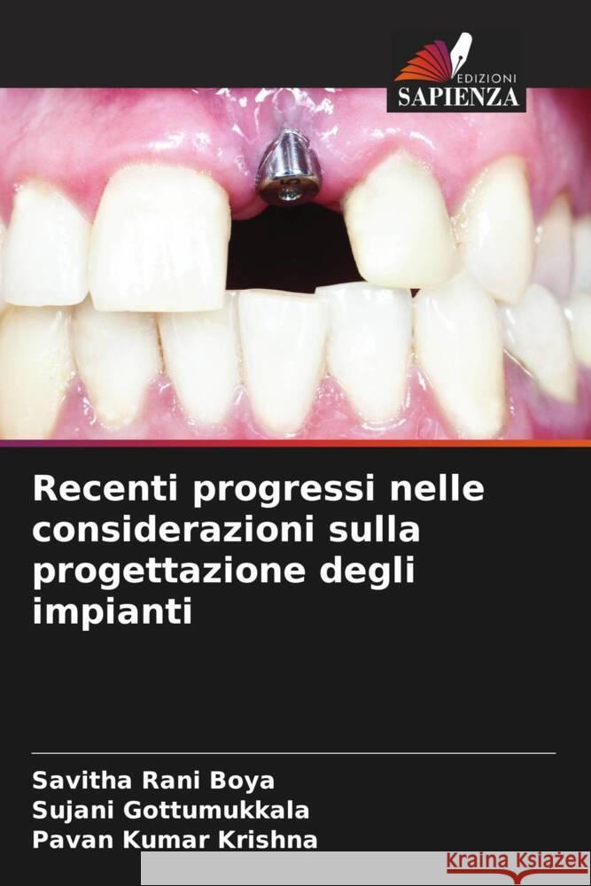 Recenti progressi nelle considerazioni sulla progettazione degli impianti Boya, Savitha Rani, Gottumukkala, Sujani, Krishna, Pavan Kumar 9786204409979