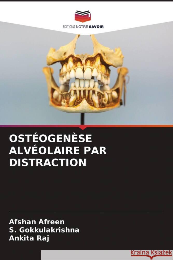 OSTÉOGENÈSE ALVÉOLAIRE PAR DISTRACTION Afreen, Afshan, Gokkulakrishna, S., Raj, Ankita 9786204415055