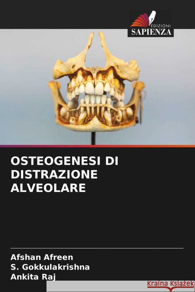 OSTEOGENESI DI DISTRAZIONE ALVEOLARE Afreen, Afshan, Gokkulakrishna, S., Raj, Ankita 9786204415062