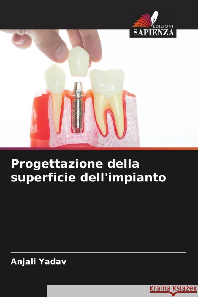 Progettazione della superficie dell'impianto Yadav, Anjali 9786204417851 Edizioni Sapienza