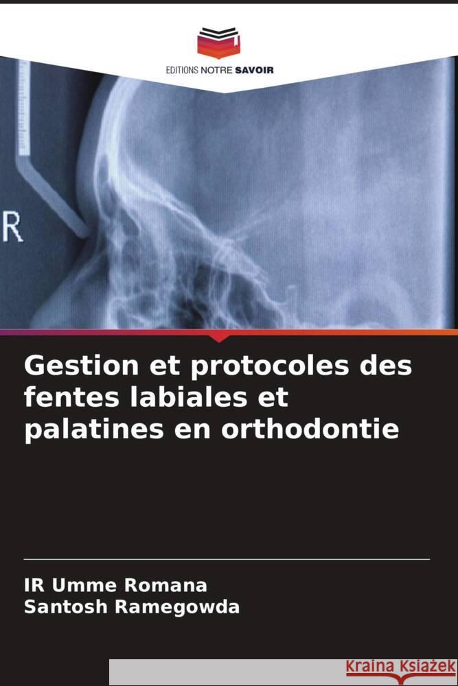 Gestion et protocoles des fentes labiales et palatines en orthodontie Romana, IR Umme, Ramegowda, Santosh 9786204419329 Editions Notre Savoir