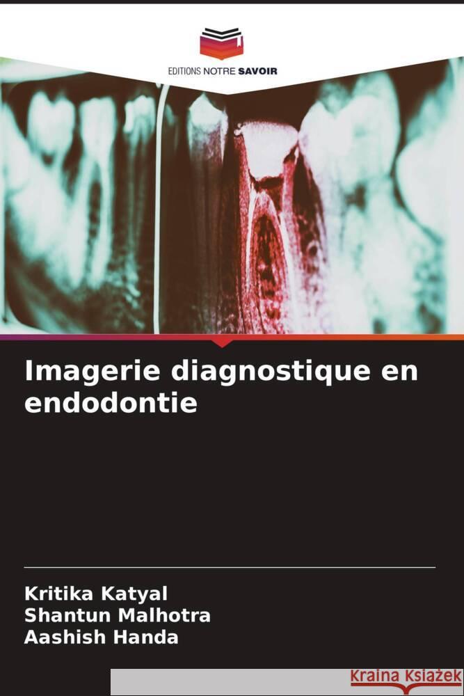 Imagerie diagnostique en endodontie Katyal, Kritika, Malhotra, Shantun, Handa, Aashish 9786204422008