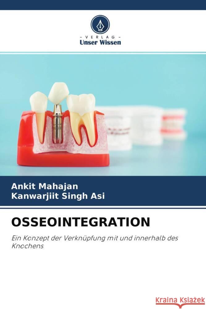 OSSEOINTEGRATION Mahajan, Ankit, Singh Asi, Kanwarjiit 9786204431970