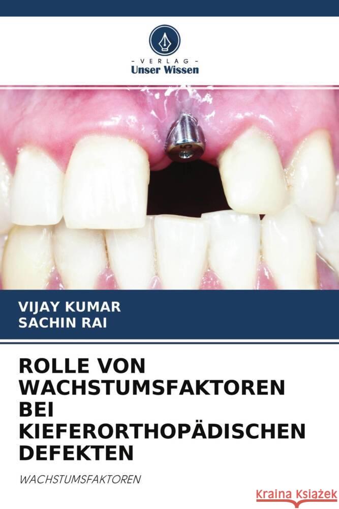 ROLLE VON WACHSTUMSFAKTOREN BEI KIEFERORTHOPÄDISCHEN DEFEKTEN Kumar, Vijay, RAI, SACHIN 9786204438252 Verlag Unser Wissen