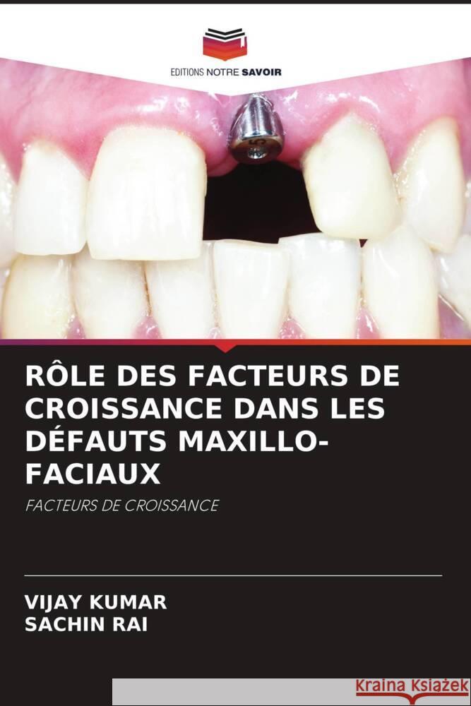 RÔLE DES FACTEURS DE CROISSANCE DANS LES DÉFAUTS MAXILLO-FACIAUX Kumar, Vijay, RAI, SACHIN 9786204438276 Editions Notre Savoir