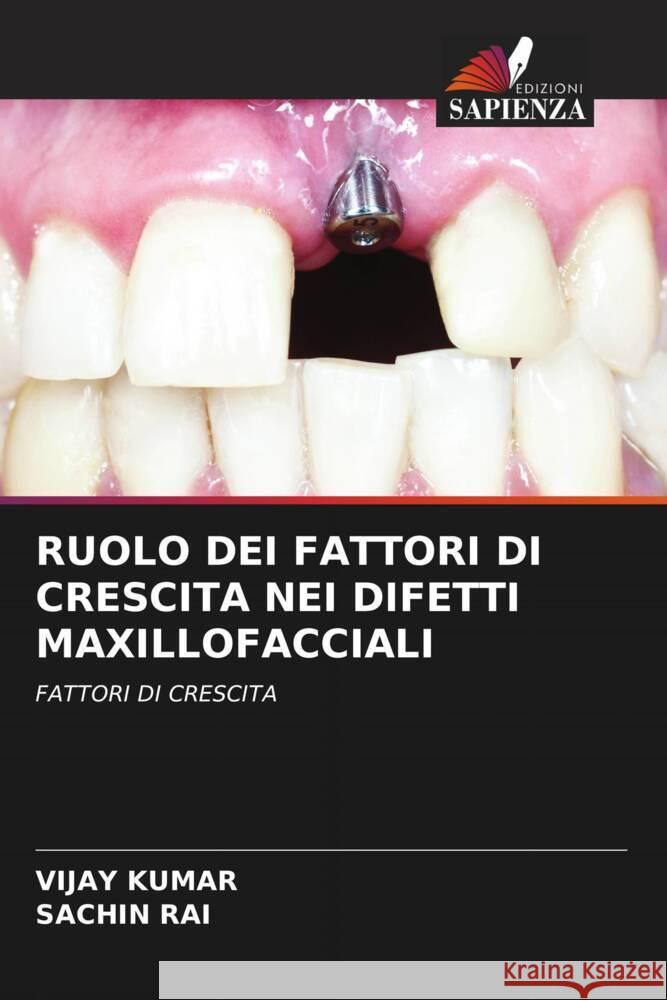 RUOLO DEI FATTORI DI CRESCITA NEI DIFETTI MAXILLOFACCIALI Kumar, Vijay, RAI, SACHIN 9786204438283 Edizioni Sapienza