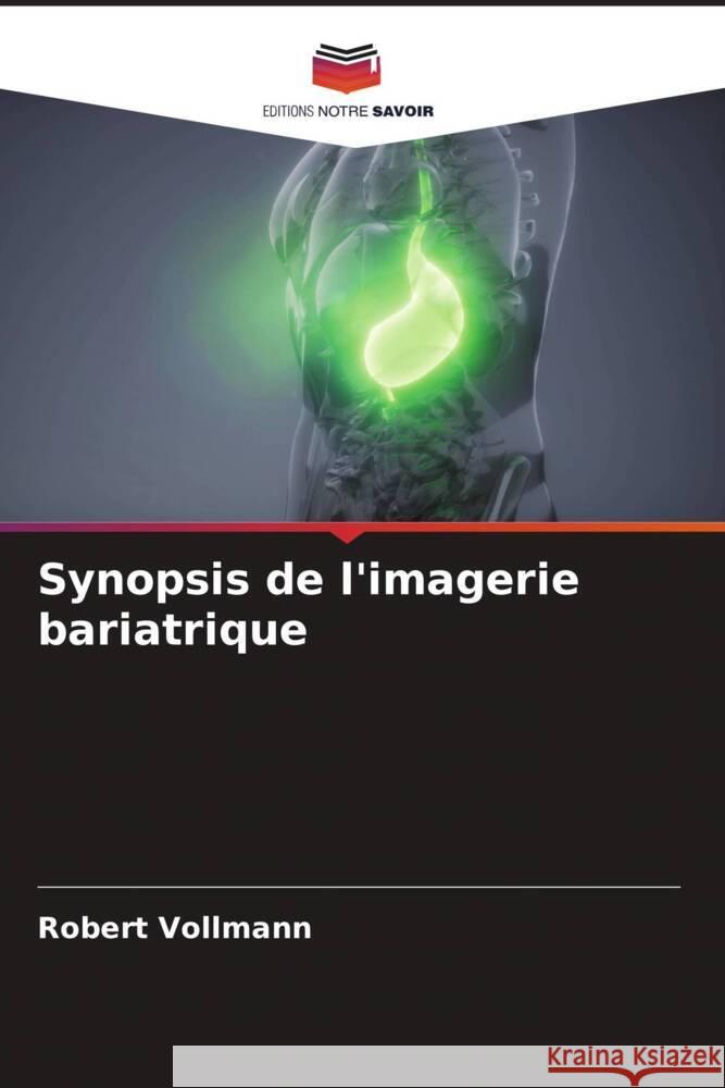 Synopsis de l'imagerie bariatrique Vollmann, Robert 9786204445168