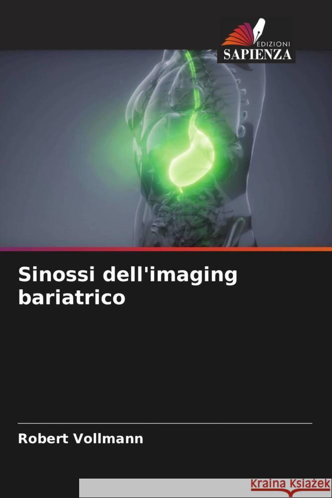 Sinossi dell'imaging bariatrico Vollmann, Robert 9786204445175