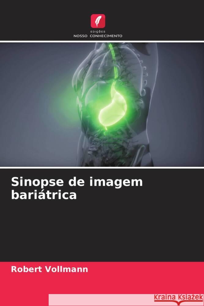 Sinopse de imagem bariátrica Vollmann, Robert 9786204445182