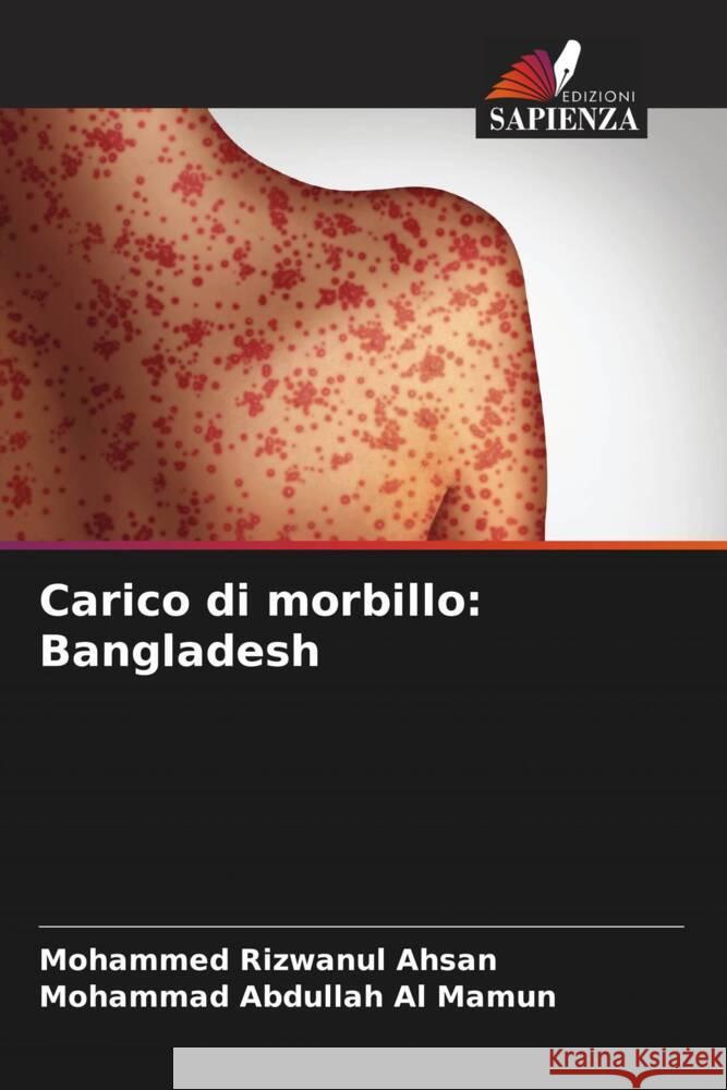 Carico di morbillo: Bangladesh Ahsan, Mohammed Rizwanul, Abdullah Al Mamun, Mohammad 9786204452500