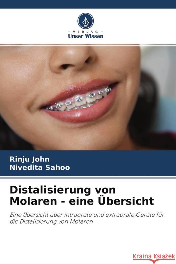 Distalisierung von Molaren - eine Übersicht John, Rinju, Sahoo, Nivedita 9786204457284