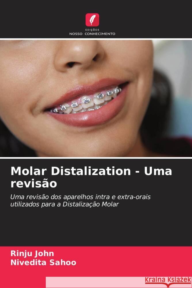 Molar Distalization - Uma revisão John, Rinju, Sahoo, Nivedita 9786204457307