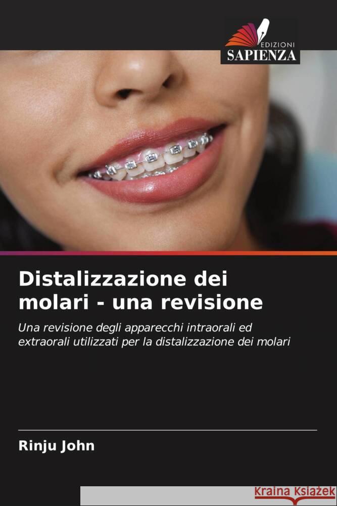 Distalizzazione dei molari - una revisione John, Rinju 9786204457345