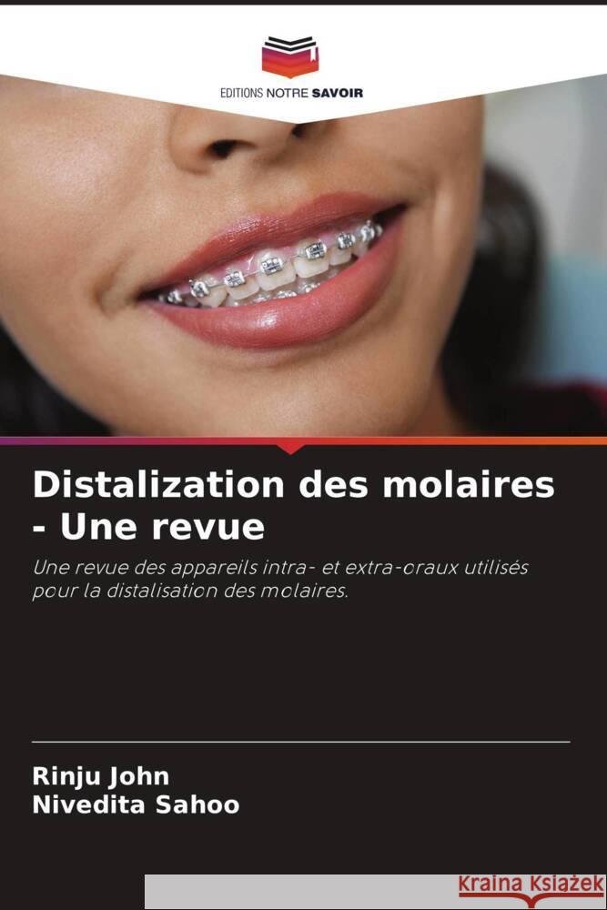 Distalization des molaires - Une revue John, Rinju, Sahoo, Nivedita 9786204457352