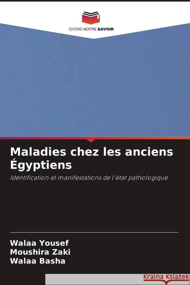 Maladies chez les anciens Égyptiens Yousef, Walaa, Zaki, Moushira, Basha, Walaa 9786204457642