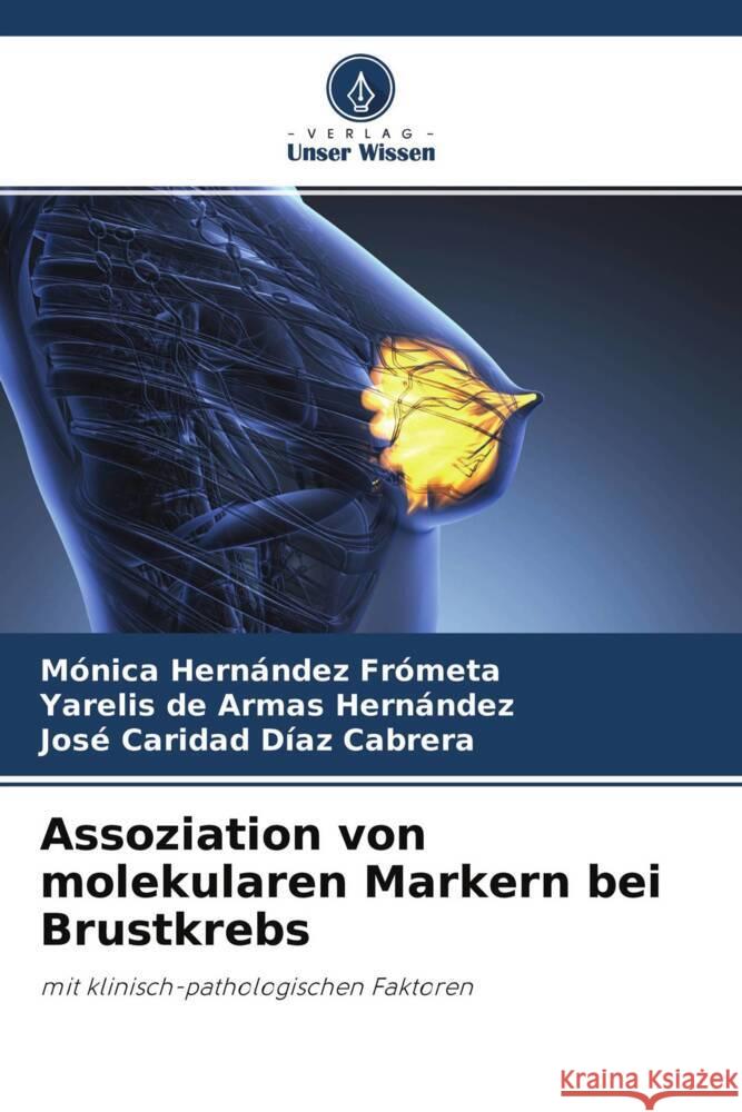 Assoziation von molekularen Markern bei Brustkrebs Hernández Frometa, Mónica, de Armas Hernández, Yarelis, Díaz Cabrera, José Caridad 9786204464398 Verlag Unser Wissen