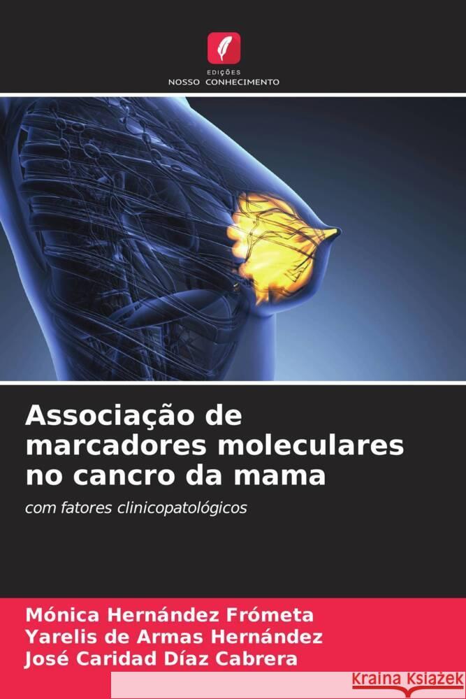 Associação de marcadores moleculares no cancro da mama Hernández Frometa, Mónica, de Armas Hernández, Yarelis, Díaz Cabrera, José Caridad 9786204464435 Edições Nosso Conhecimento