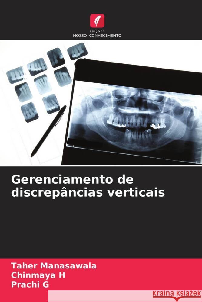 Gerenciamento de discrepâncias verticais Manasawala, Taher, H, Chinmaya, G, Prachi 9786204467764 Edições Nosso Conhecimento