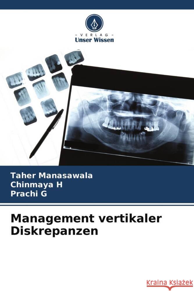Management vertikaler Diskrepanzen Manasawala, Taher, H, Chinmaya, G, Prachi 9786204467771