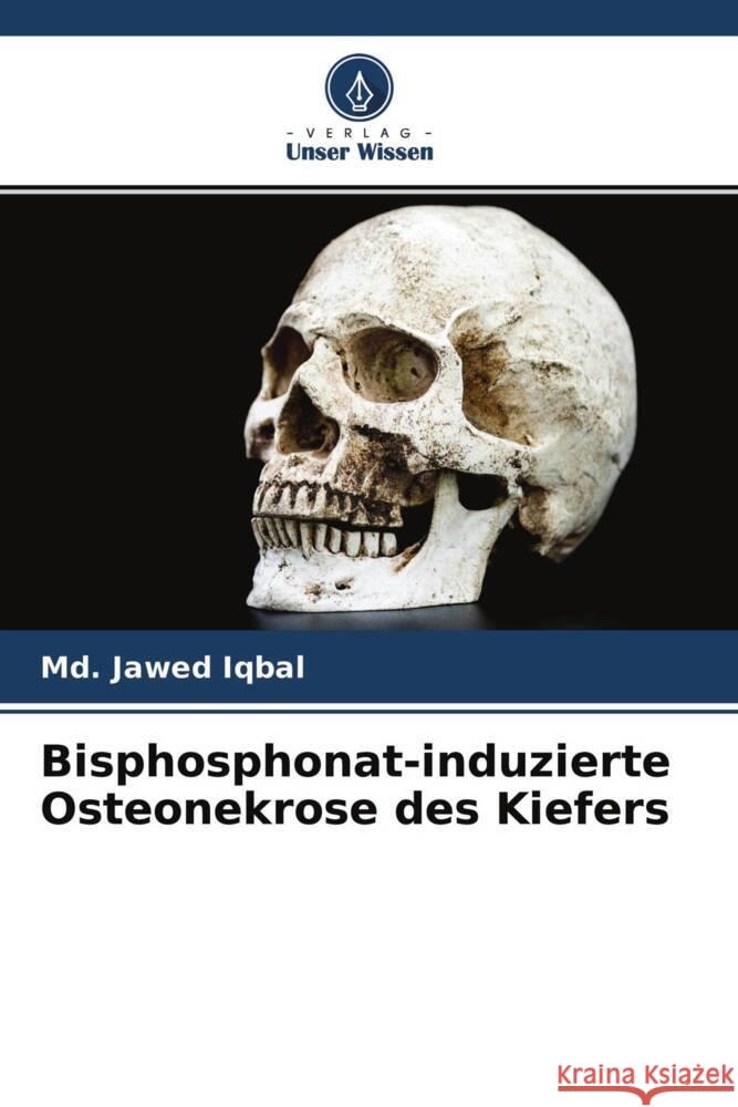 Bisphosphonat-induzierte Osteonekrose des Kiefers Iqbal, Md. Jawed 9786204468549