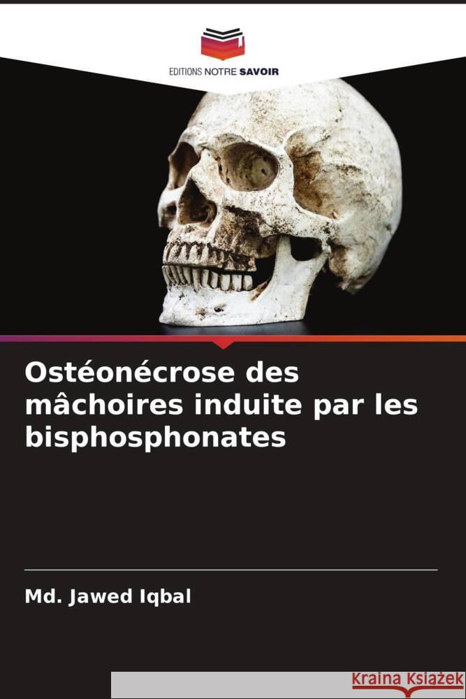 Ostéonécrose des mâchoires induite par les bisphosphonates Iqbal, Md. Jawed 9786204468563