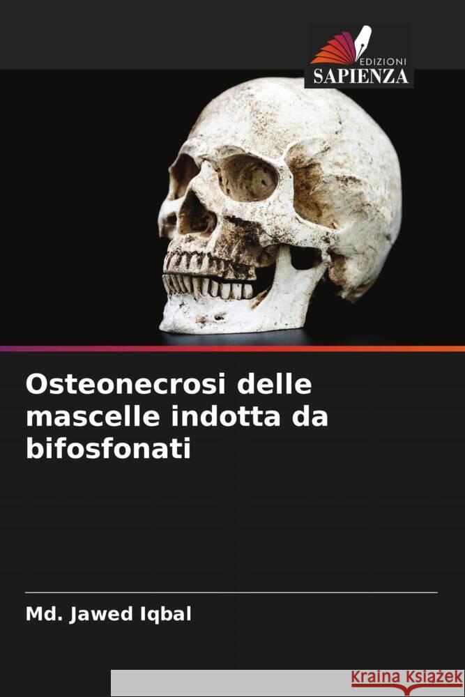 Osteonecrosi delle mascelle indotta da bifosfonati Iqbal, Md. Jawed 9786204468570