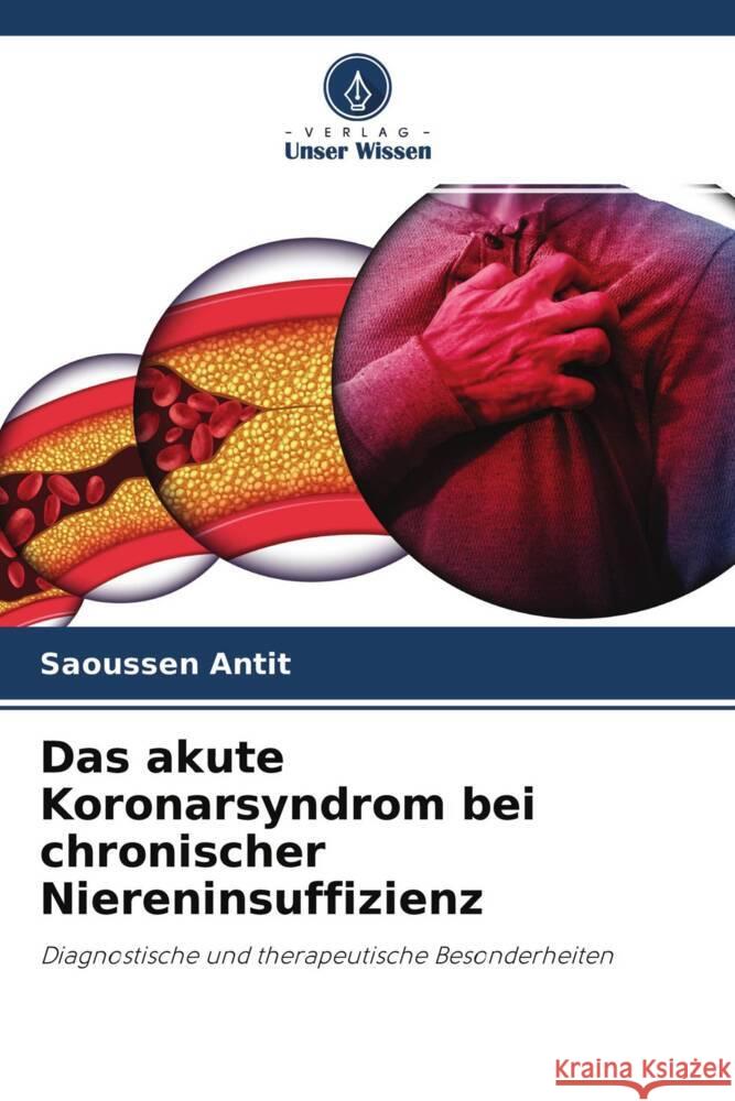 Das akute Koronarsyndrom bei chronischer Niereninsuffizienz Antit, Saoussen 9786204485546